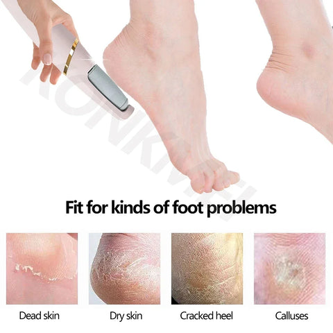 Rechargeable Foot Callus Remover - Smooth & Soften Hard, Cracked Skin Instantly